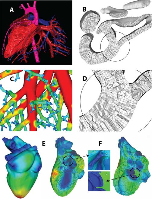 picture of mesh4