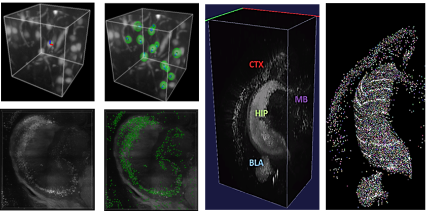 mesoscopic cell detection whole brain