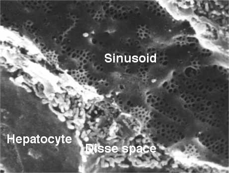 sinusoid pic1