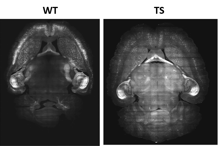 Whole brain Imaging of DS mouse model